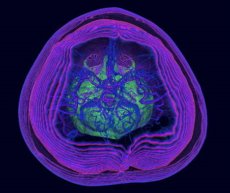 CT Scan Art Human Head