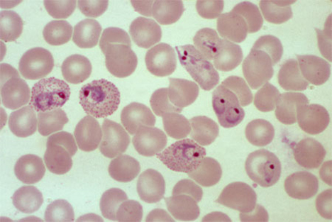 blood cells microscope