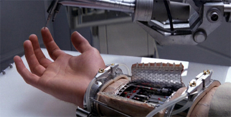 cybernetic arm