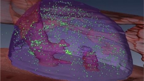 cryo-imager 3d images of cancer cells