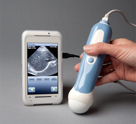 Home deals ultrasound machine