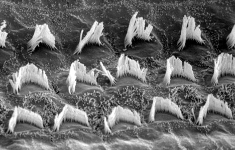 auditory hair cells