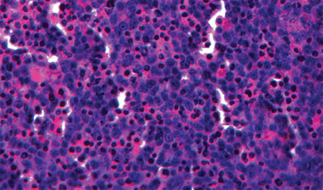 3d printed liver tissue