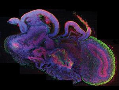 lab grown human brains