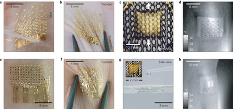 skin adhering temperature sensor