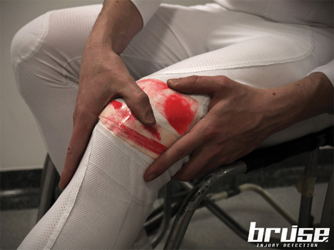 bruise athletic suit