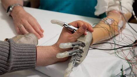 prosthetic hand able to feel