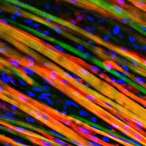 manufactured bio-engineered self-healing muscle