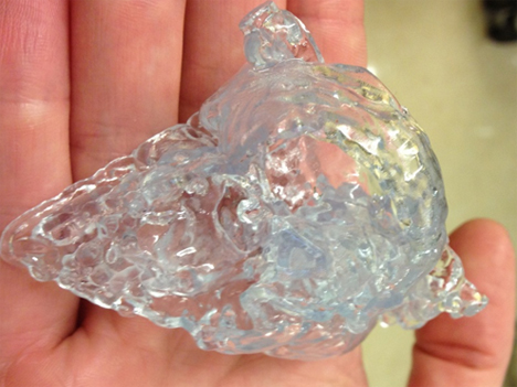 life saving 3d printed patients heart