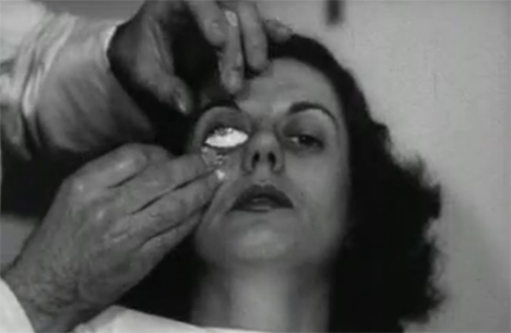 Cringeworthy Contact Lens Fitting Procedure Of The 1940s Gadgets Science Technology