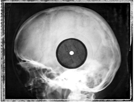 x ray records