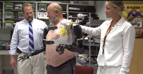 bilateral prosthetic cyborg arms