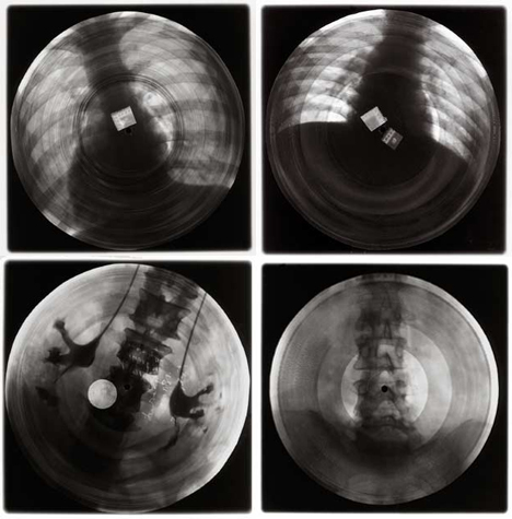 records printed on x rays