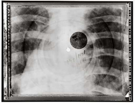 repurposed x rays turned into records