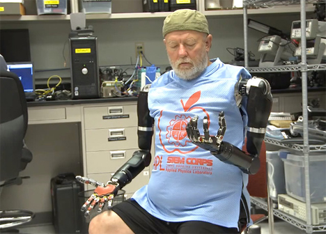 world's first double mind controlled prosthetic arms