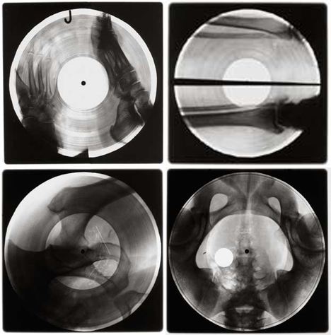 x ray records