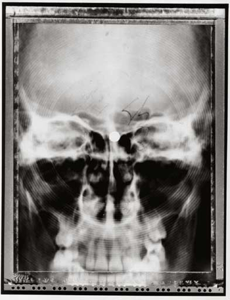 x rays made into records