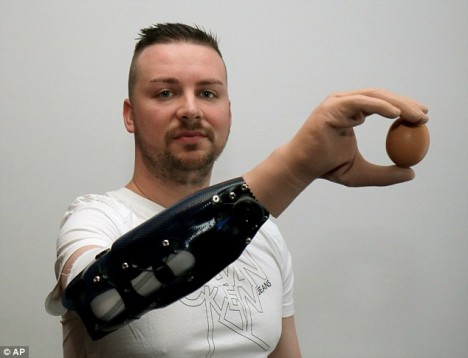 bionic hand function