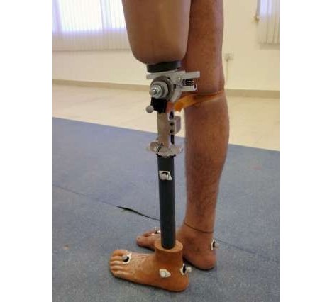 inexpensive prosthetic leg with bending knee