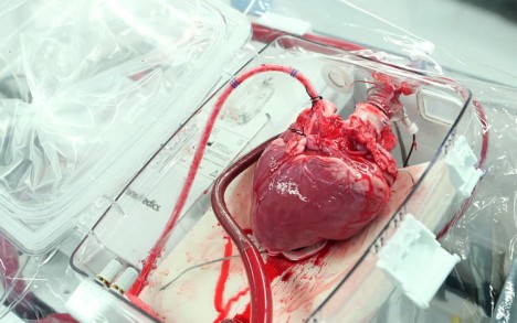 box keeps transplant hearts alive