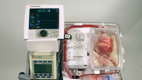 heart revival transplant machine