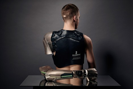 NNN / Bionic Prosthetic Arm with Personal Drone